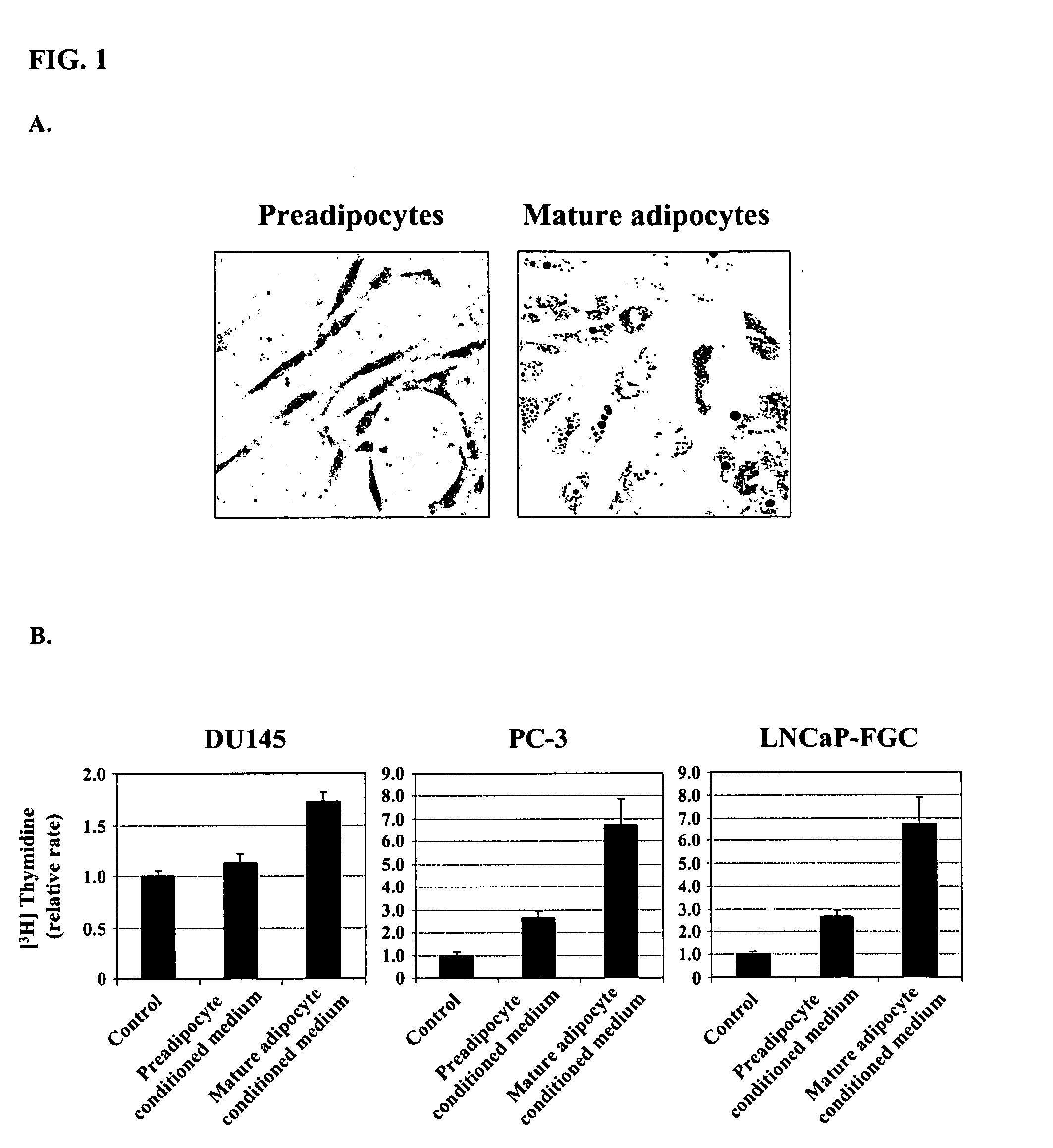 Method of treating, preventing, and diagnosing prostate cancer