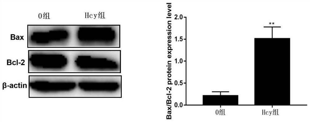 Traditional Chinese medicine composition for preventing and treating atherosclerosis