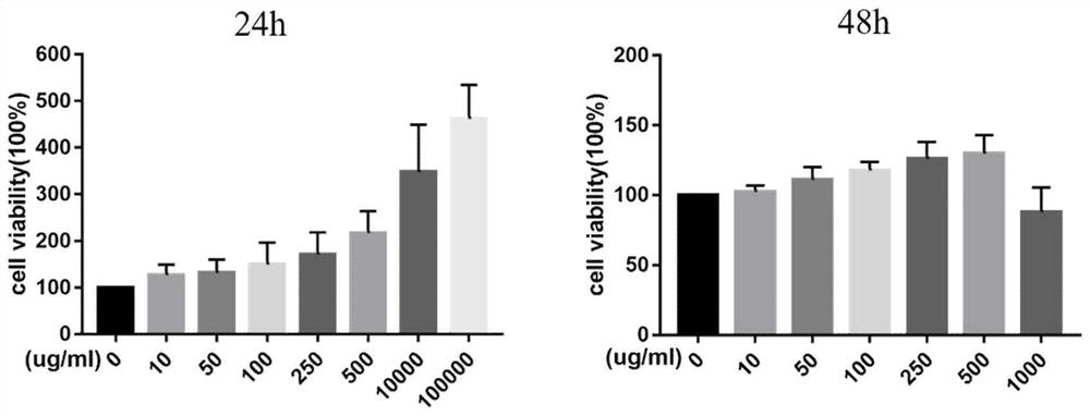 Traditional Chinese medicine composition for preventing and treating atherosclerosis