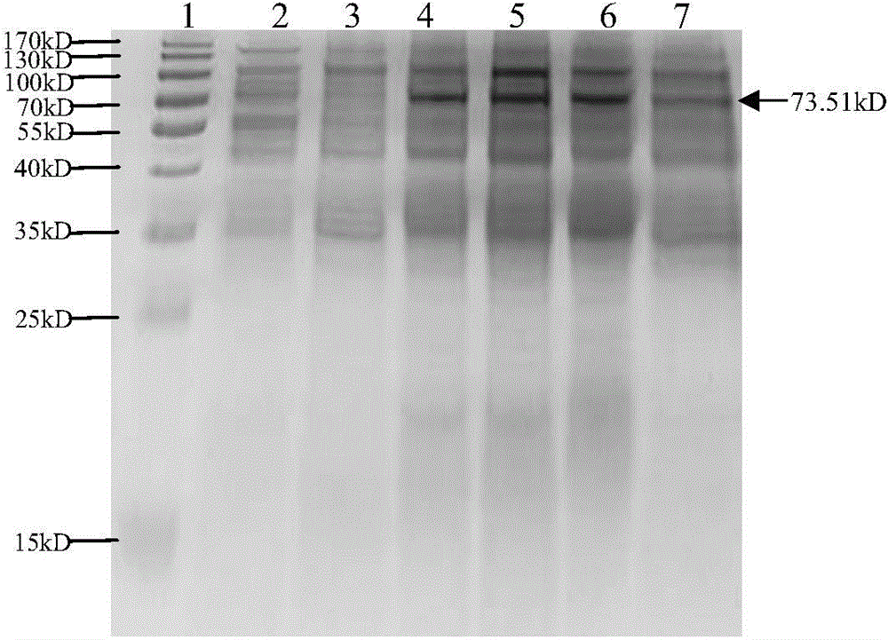 Formic acid cleavage site peptide, correlative biomaterial and applications of formic acid cleavage site peptide and correlative biomaterial in production of calcitonin