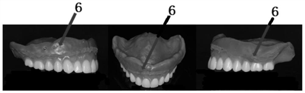 Method for making complete dentures with individualized polished surfaces using old dentures