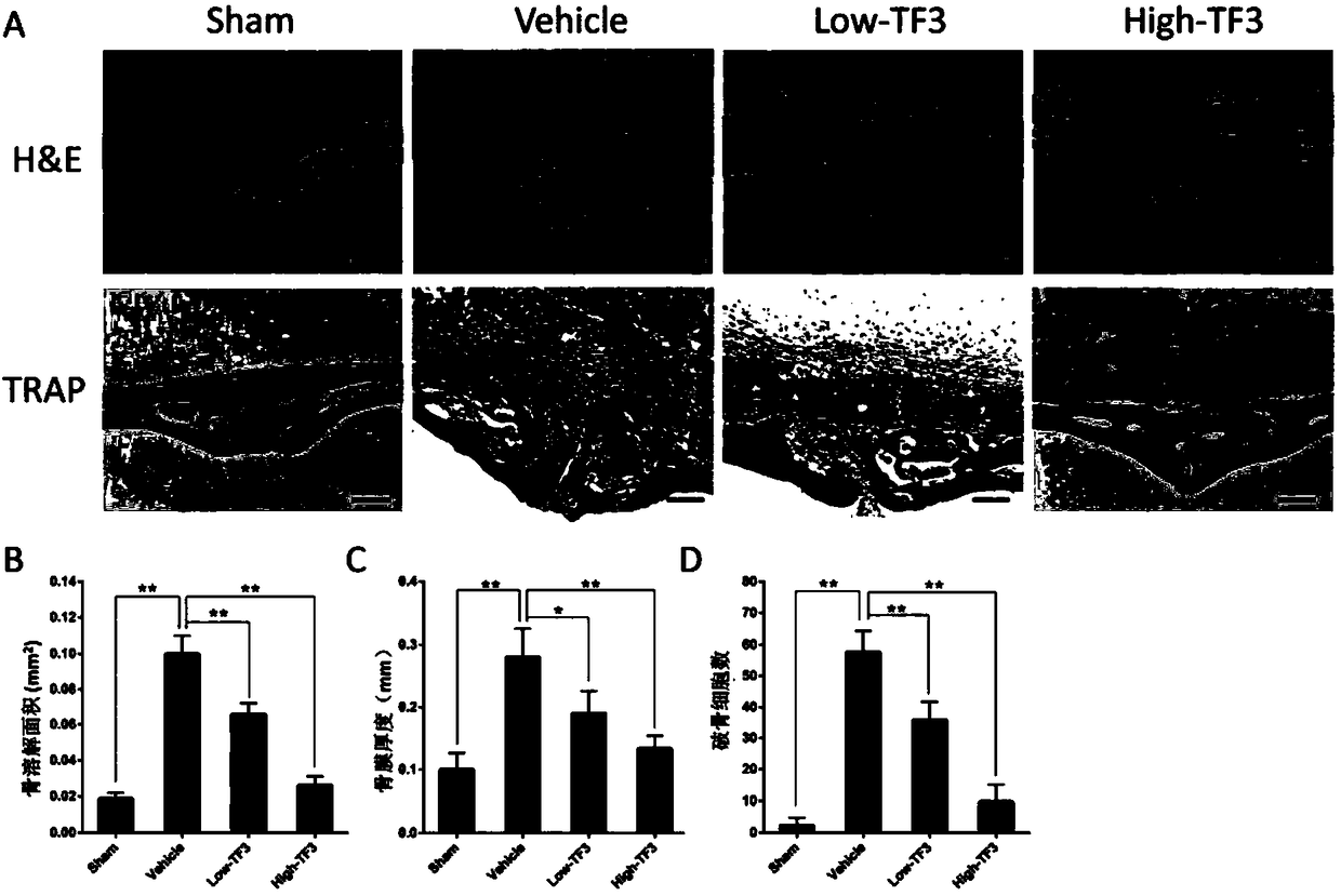 Uses of theaflavin-3,3'-digallate