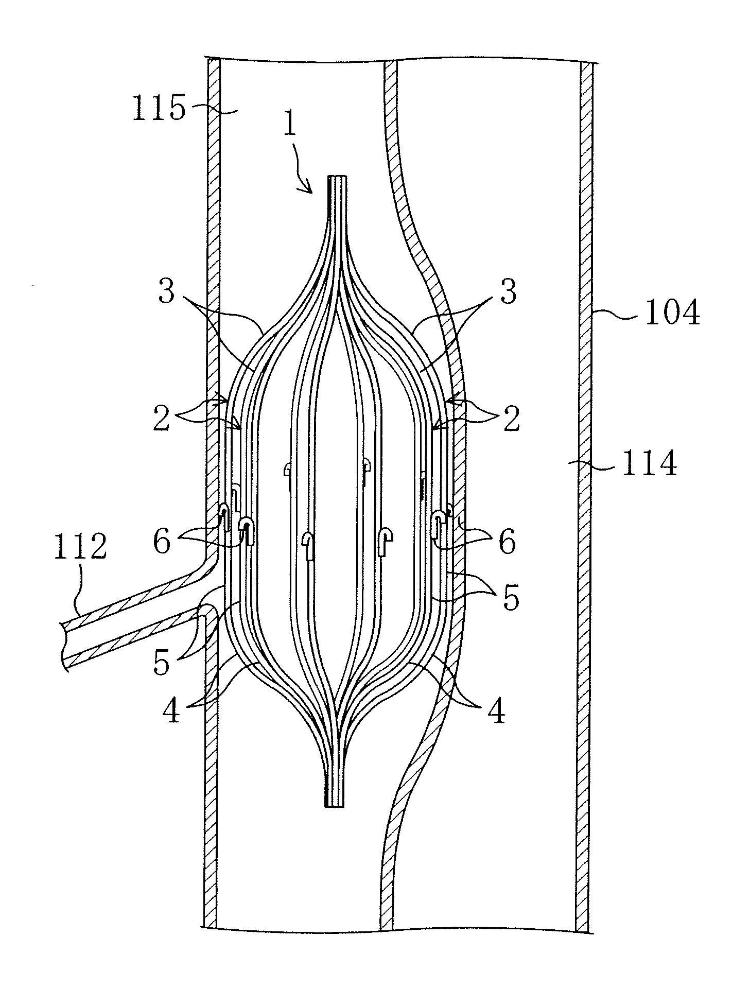 Instrument for dilating blood channel and instrument for treating aortic dissection