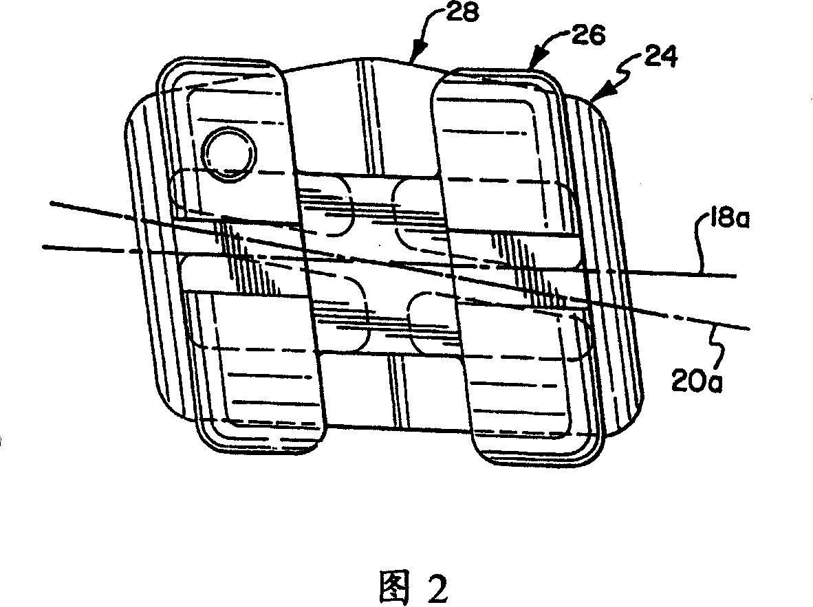 Square silk bow denture trough for capture invalid torque