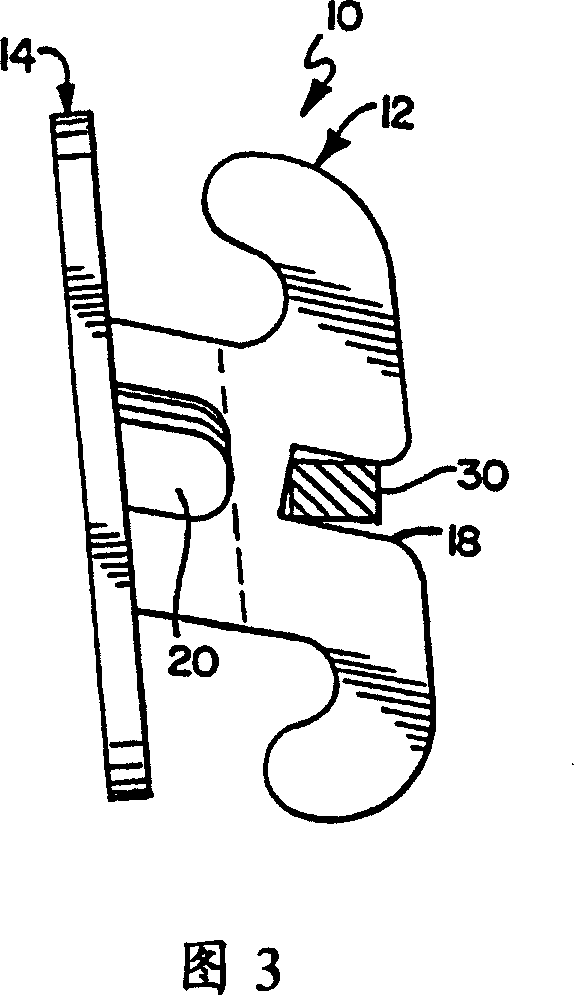 Square silk bow denture trough for capture invalid torque