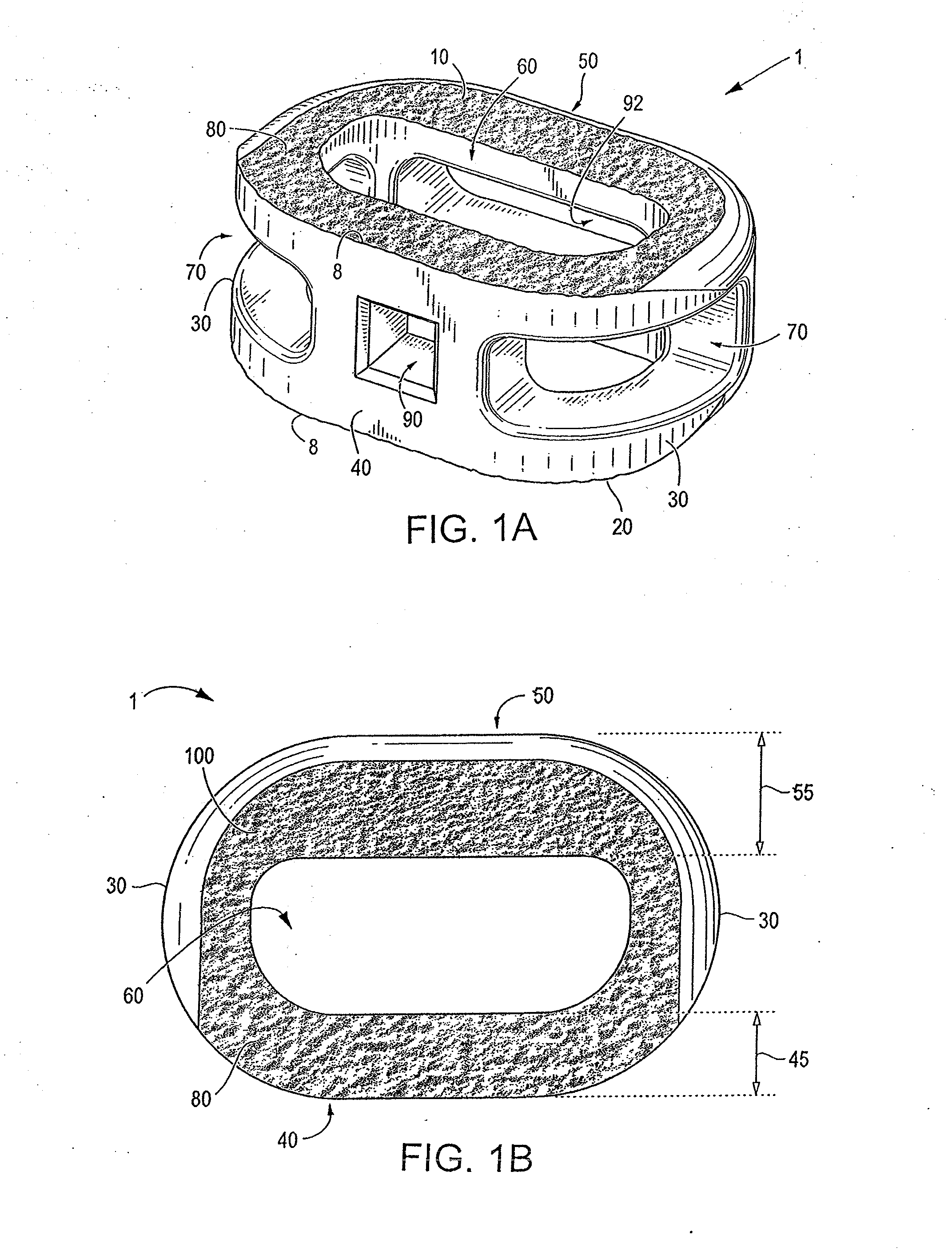 Endplate-preserving spinal implant with an integration plate having a roughened surface topography