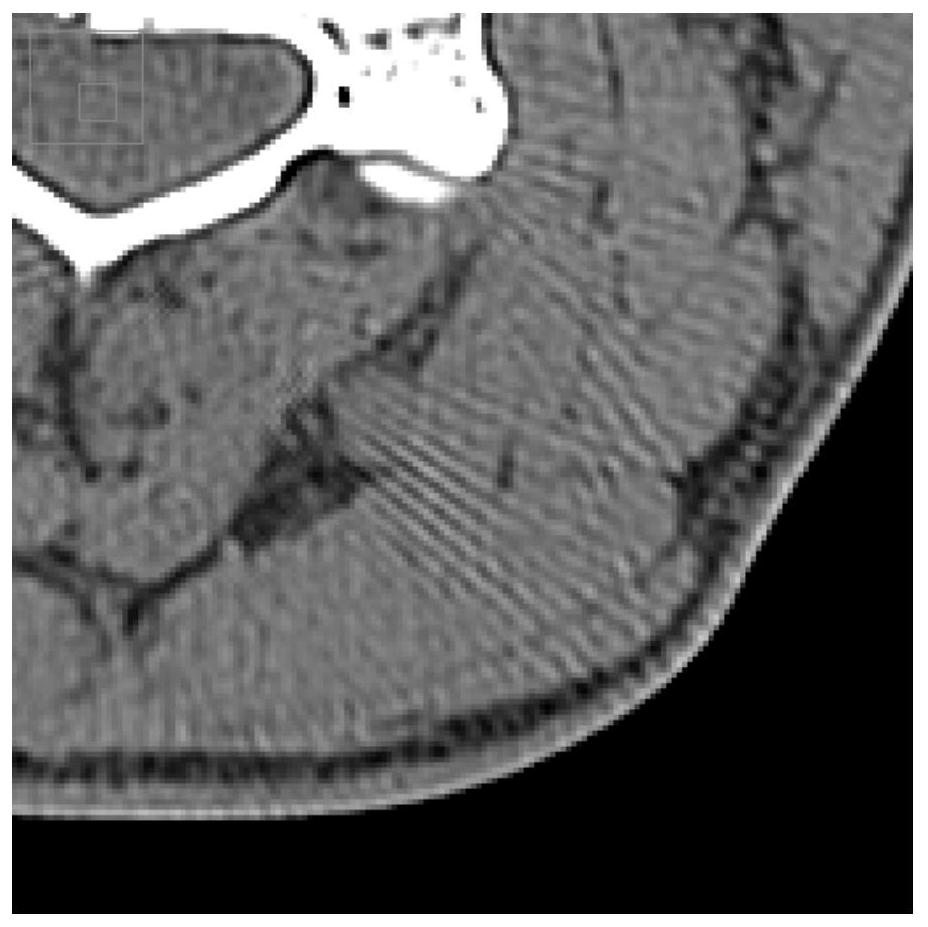 CT image artifact removing method