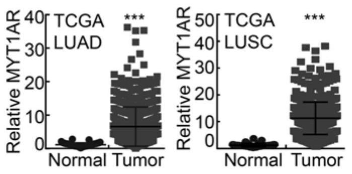 Human PKMYT1AR gene and application thereof