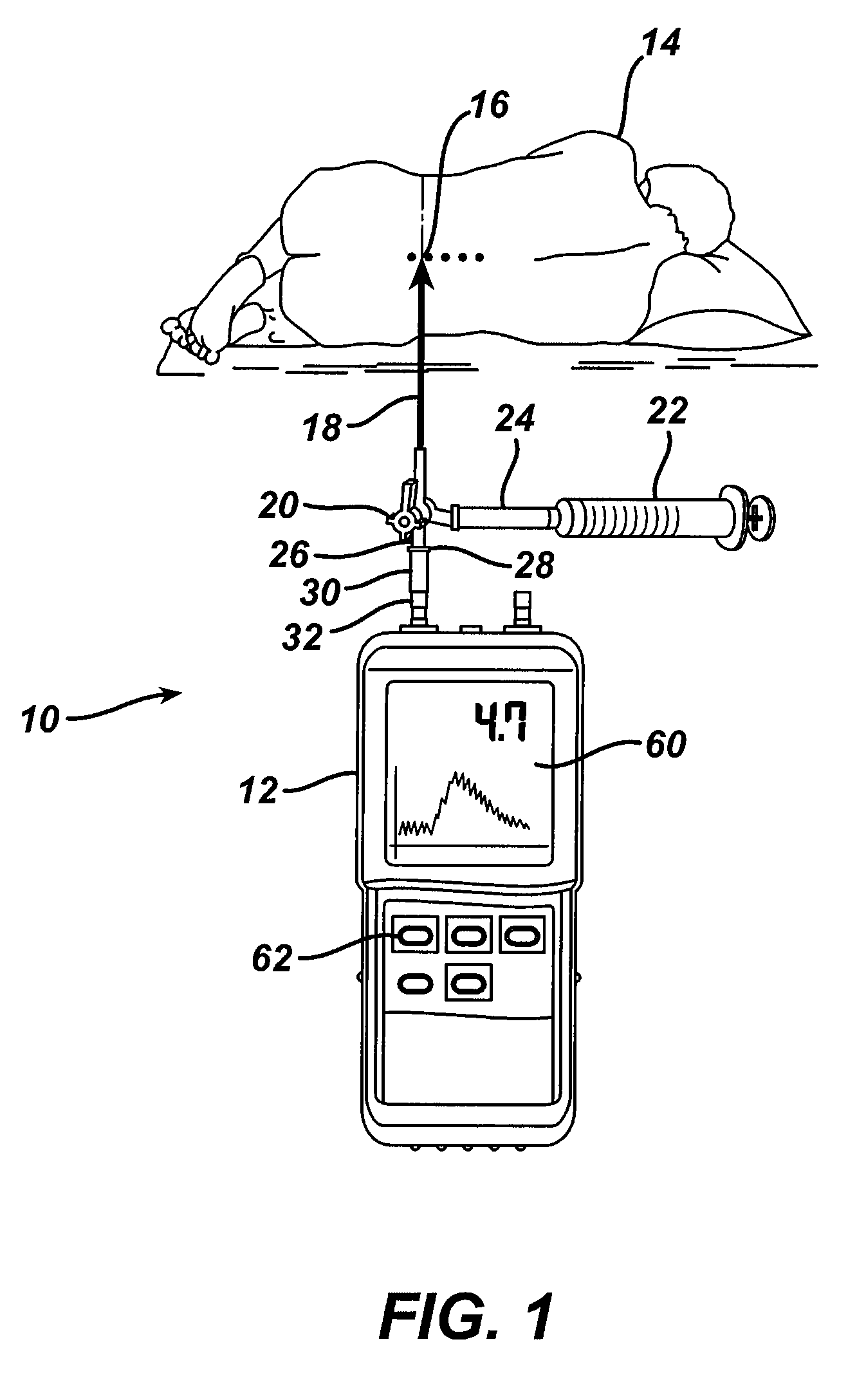 System and method for measuring the pressure of a fluid system within a patient