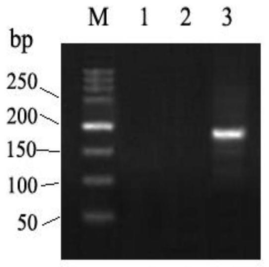 A rhd blood group gene rhd993c&gt;t allele and its application