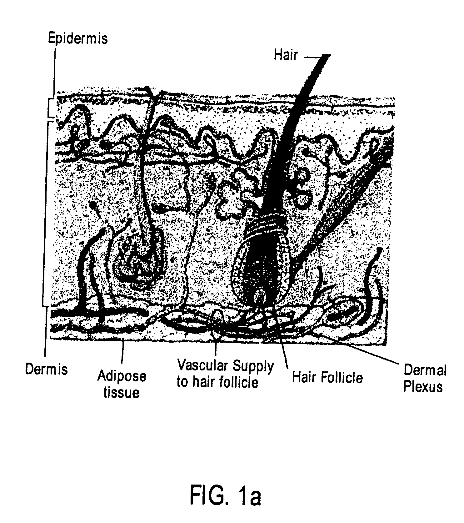 Apparatuses and methods to treat biological external tissue