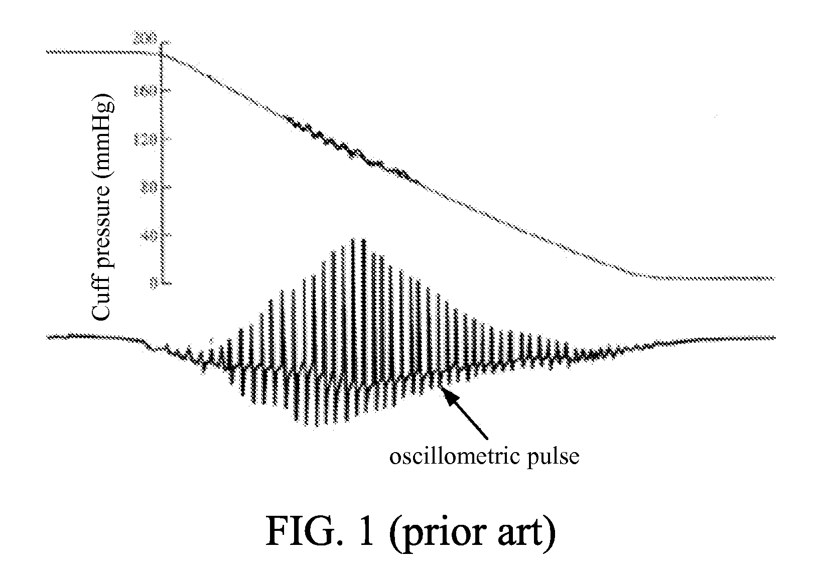 Apparatus and method for measuring blood pressure with motion artifacts elimination