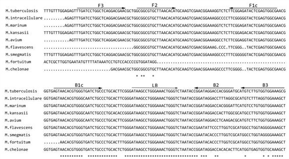 Primer composition, corresponding kit and detection method for rt-lamp detection of live bacteria of Mycobacterium tuberculosis