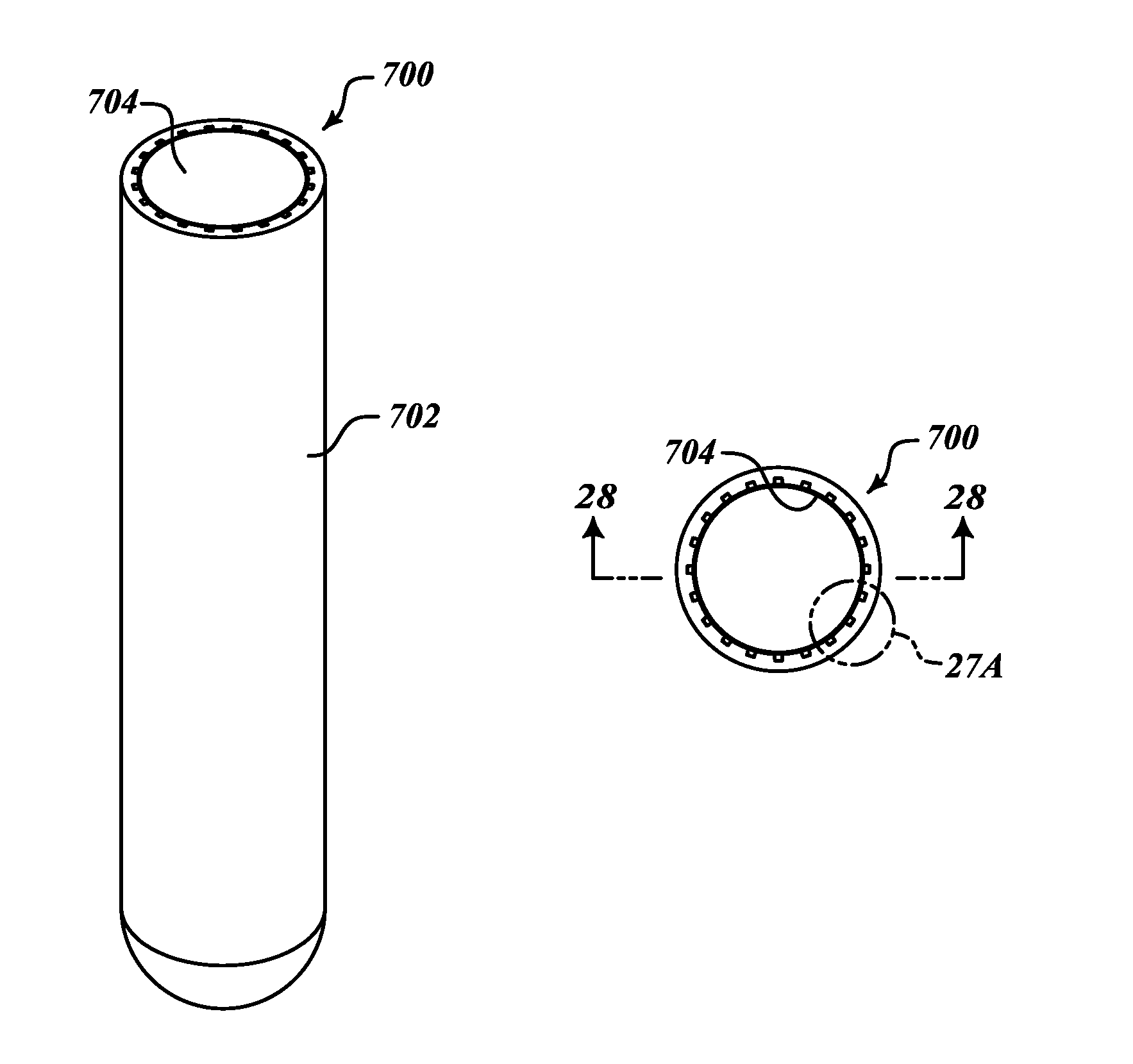 Adjustable prosthesis