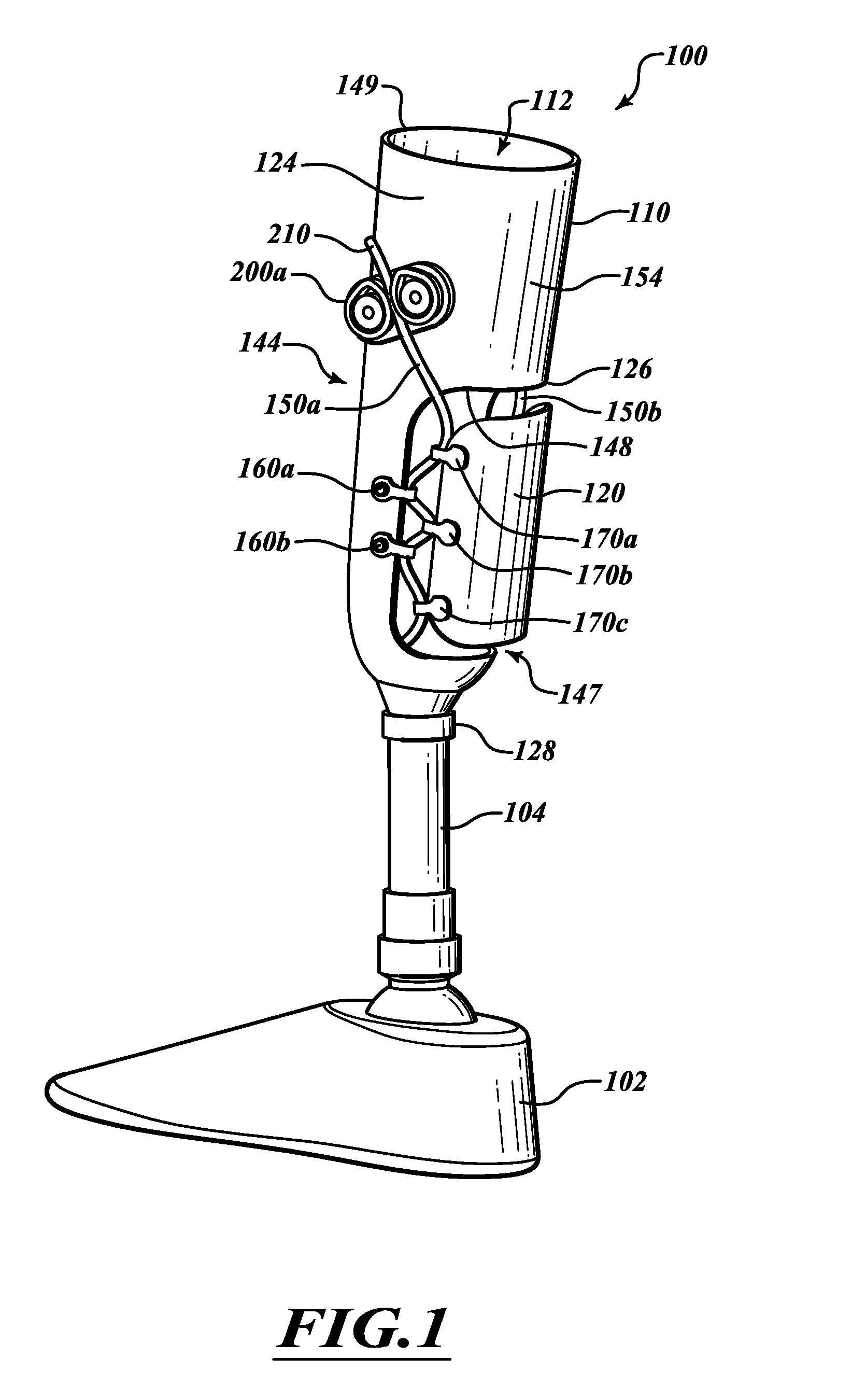 Adjustable prosthesis