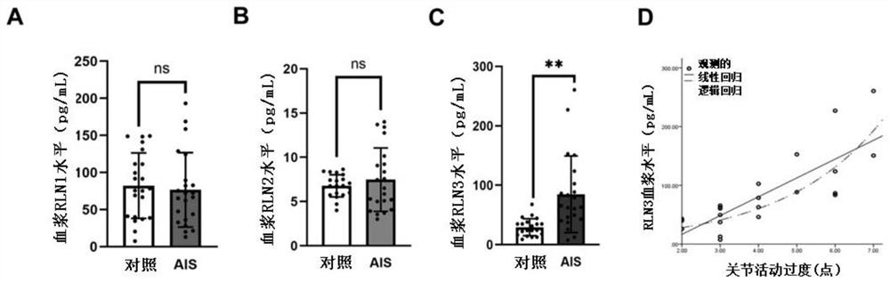 Application of RXFP1/3 inhibitor in preparation of medicine for preventing or treating adolescent idiopathic scoliosis disease