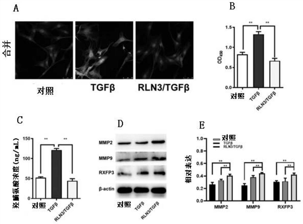 Application of RXFP1/3 inhibitor in preparation of medicine for preventing or treating adolescent idiopathic scoliosis disease