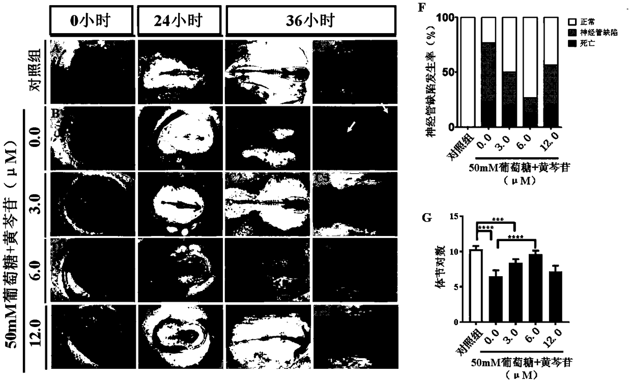 Application of baicalin in preparation of drug for treating fetal neural tube defect caused by gestational diabetes mellitus