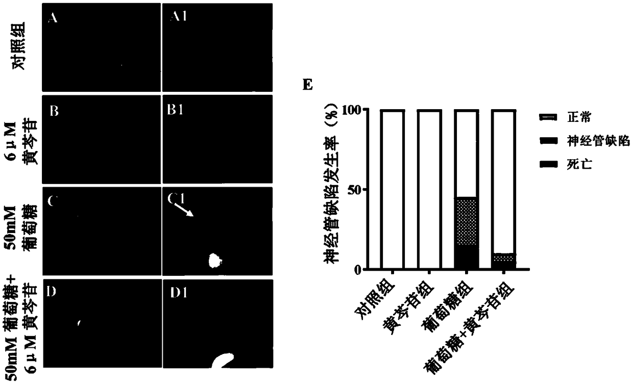 Application of baicalin in preparation of drug for treating fetal neural tube defect caused by gestational diabetes mellitus