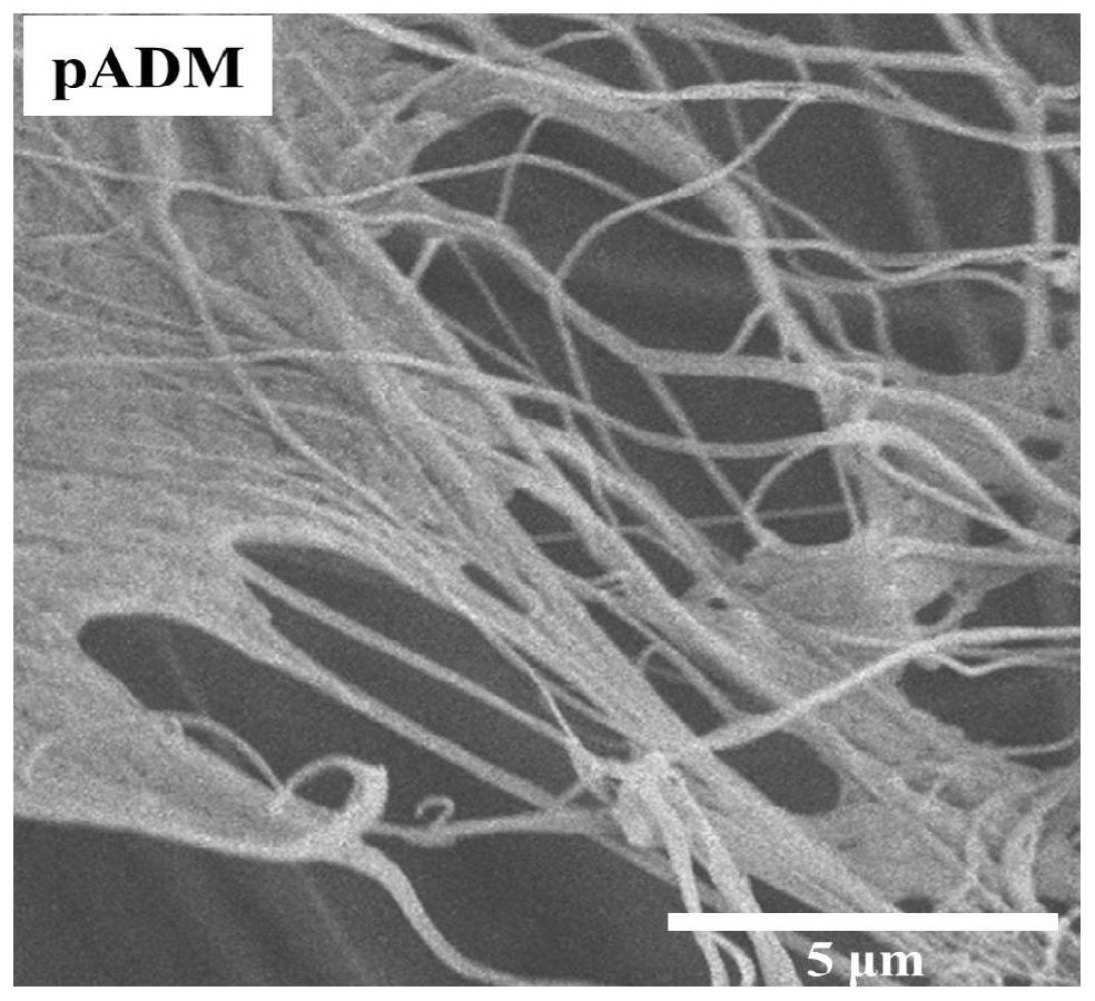 Preparation method and application of acellular porcine dermal matrix antibacterial conductive skin scaffold