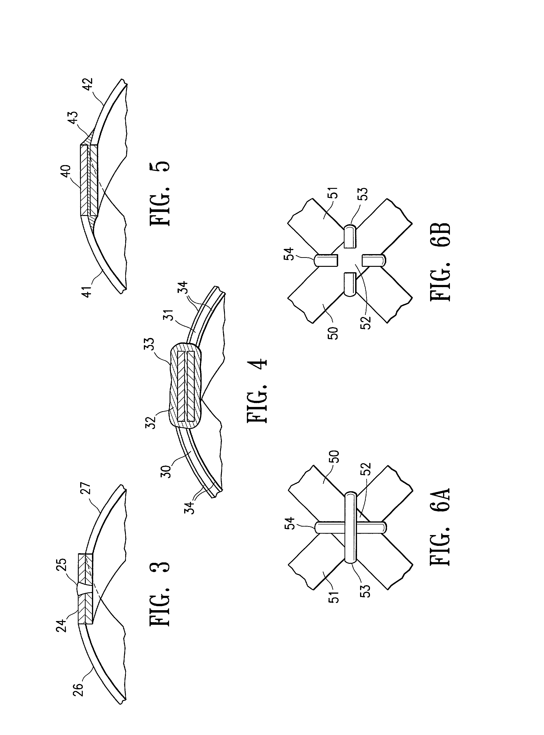 Catheter with enhanced reinforcement