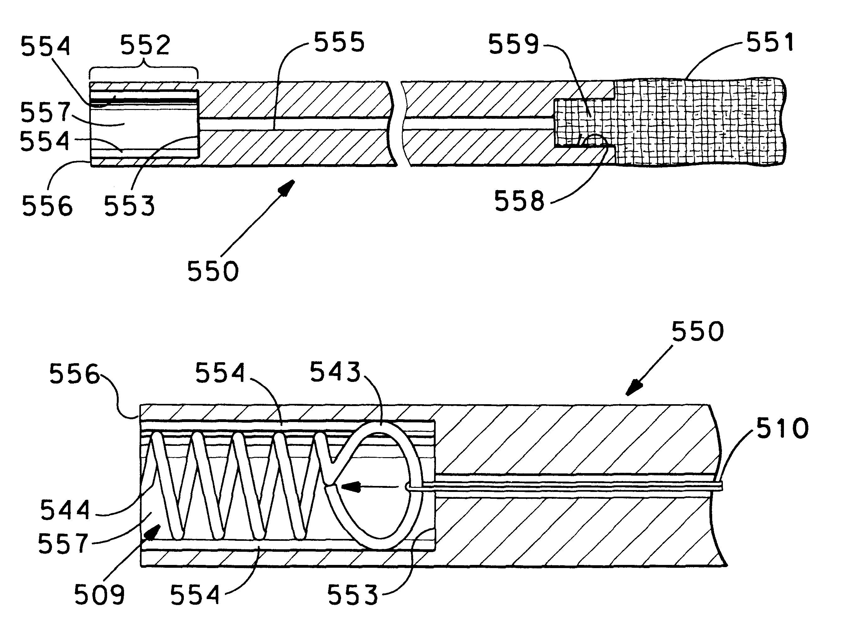 Surgical method for treating urinary incontinence, and apparatus for use in same