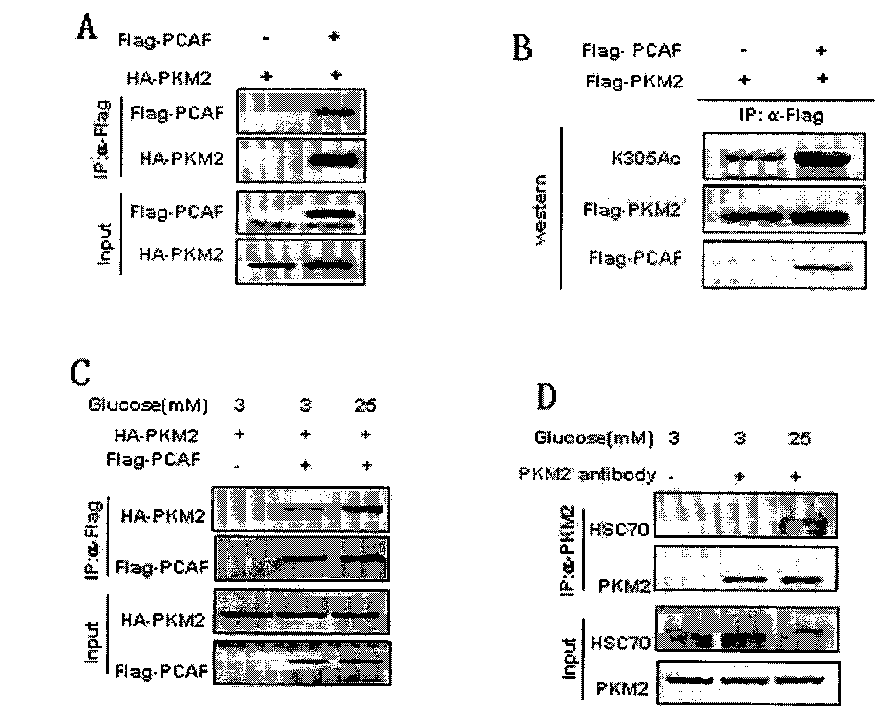 Inhibitor for acetylation of pyruvate kinase 2 (PKM2) and use thereof