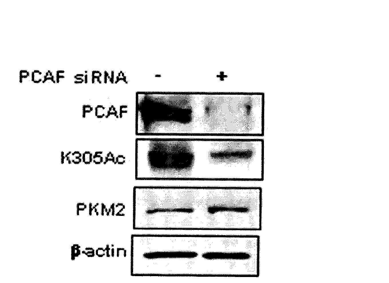 Inhibitor for acetylation of pyruvate kinase 2 (PKM2) and use thereof