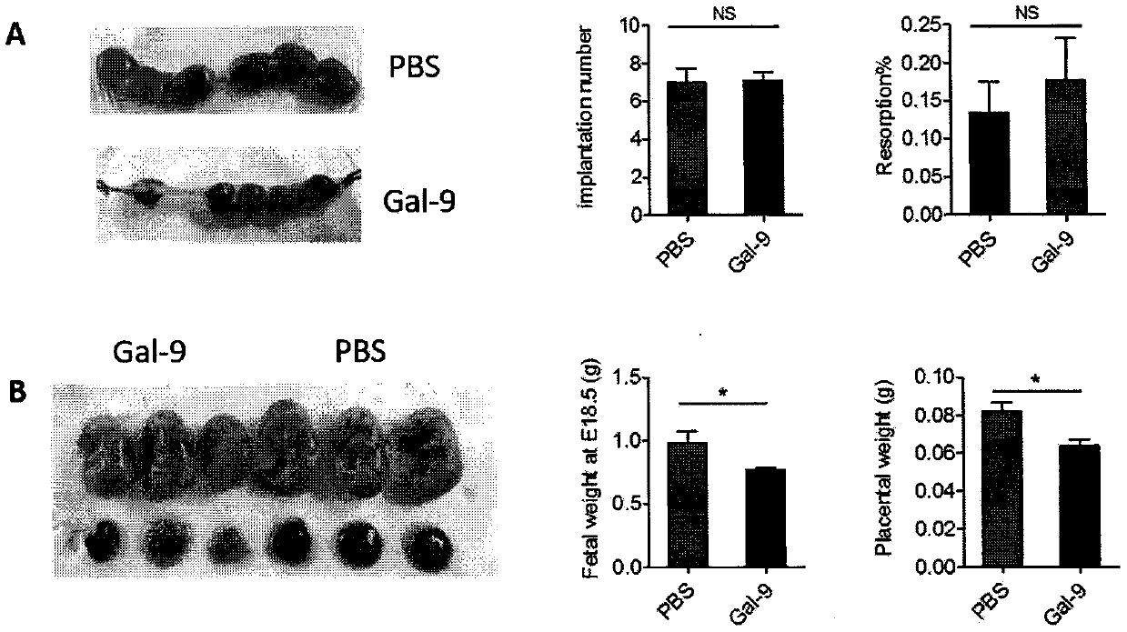 Method for constructing mouse preeclampsia model