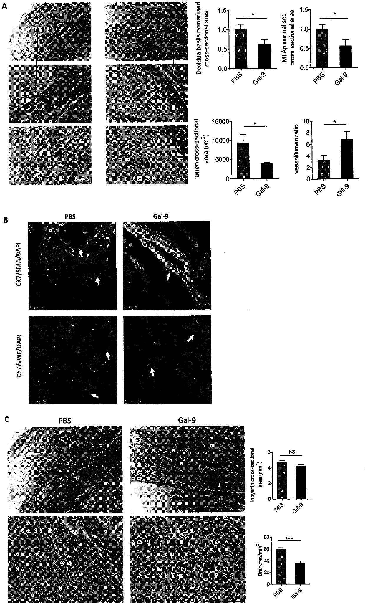 Method for constructing mouse preeclampsia model