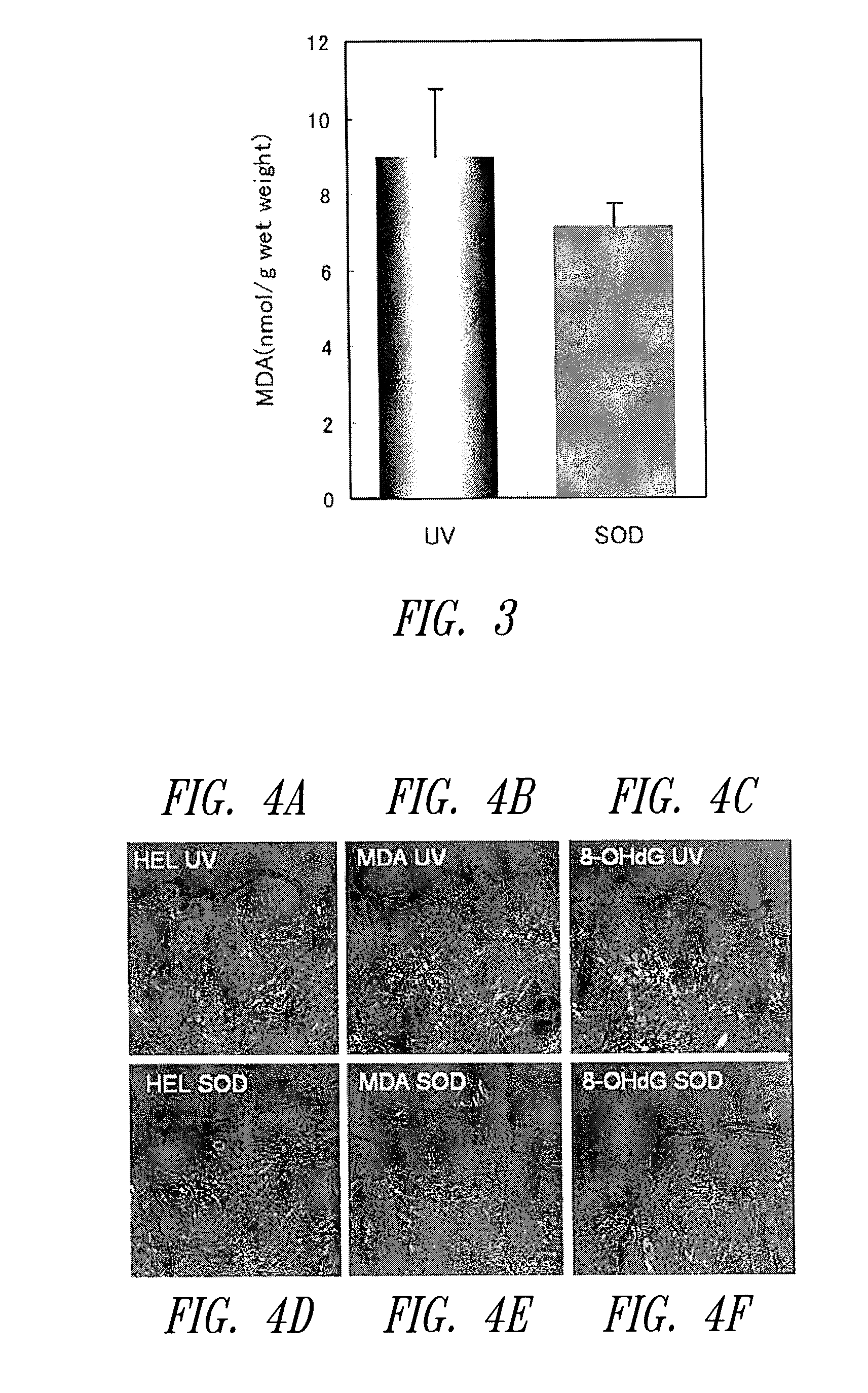 System, devices, and methods for iontophoretic delivery of compositions including antioxidants encapsulated in liposomes