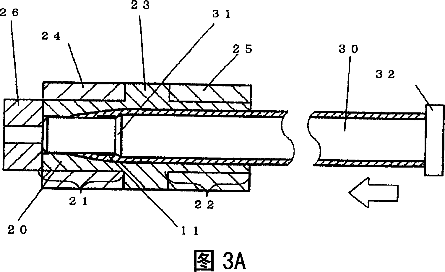 Medical catheter and its manufacture