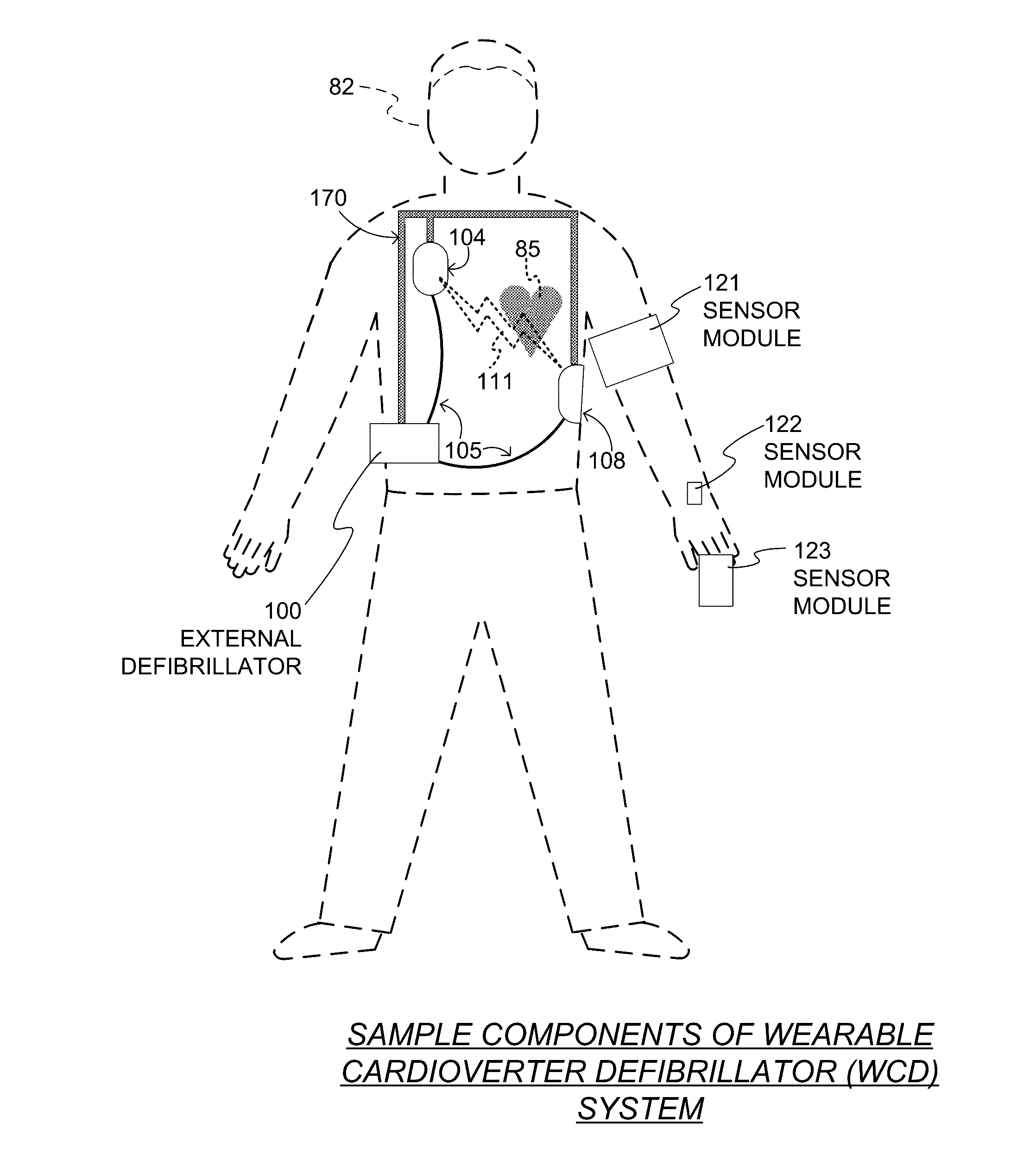 Wearable cardioverter defibrillator (WCD) system using sensor modules for confirmation before shock