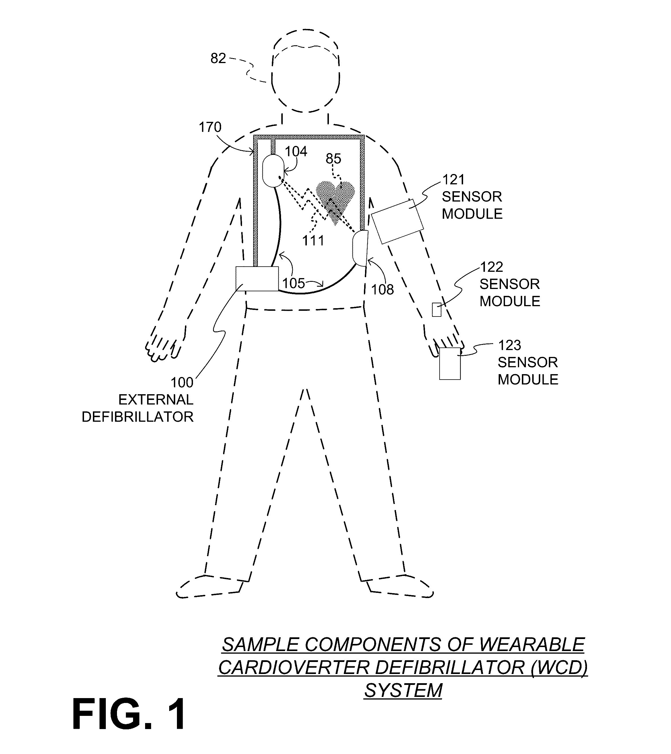 Wearable cardioverter defibrillator (WCD) system using sensor modules for confirmation before shock