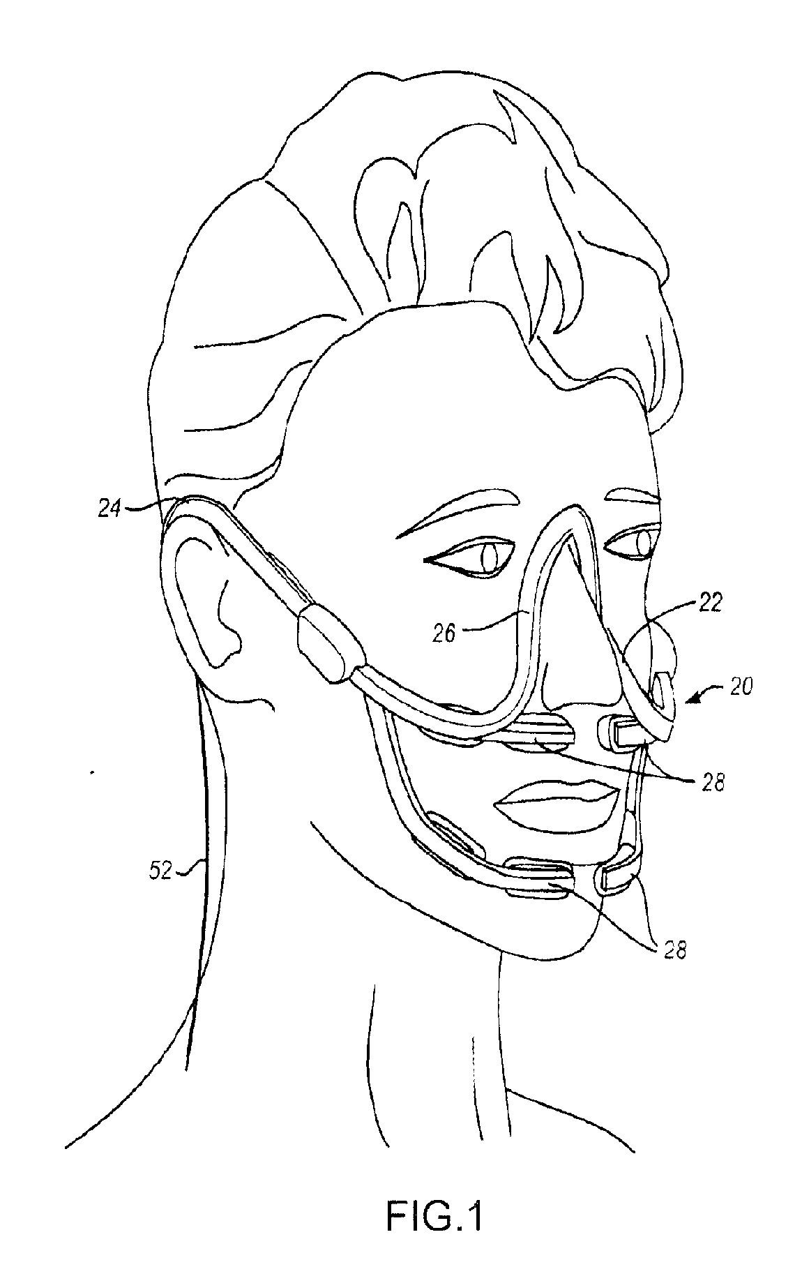 Method and apparatus for tooth regulation with heavy forces