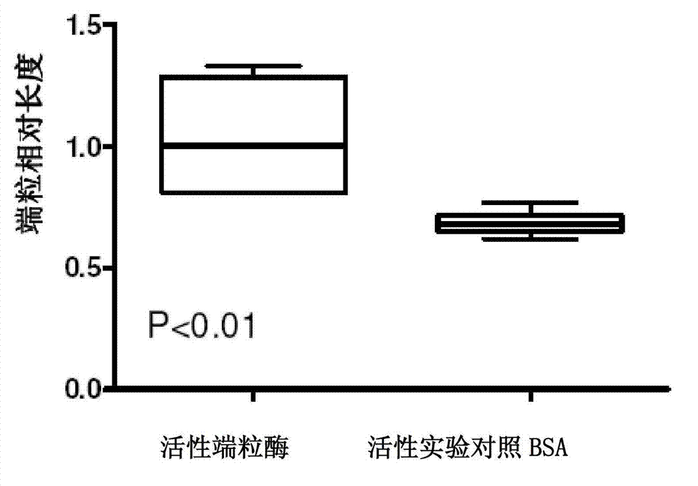 Intelligent nano delivery system, preparation method and application thereof