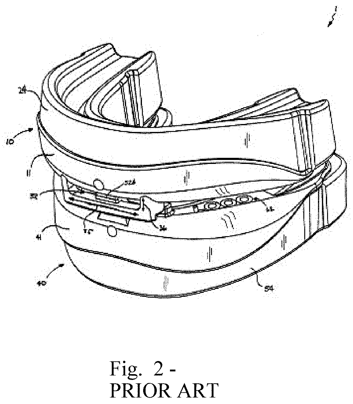 Non-invasive handling of sleep apnea, snoring and emergency situations