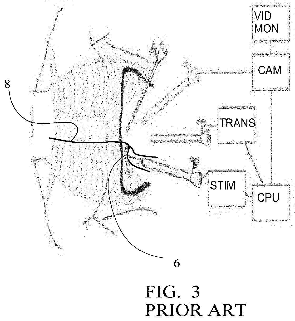 Non-invasive handling of sleep apnea, snoring and emergency situations