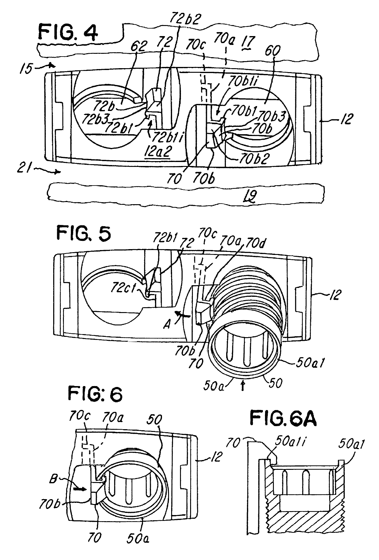 Spinal implant and assembly