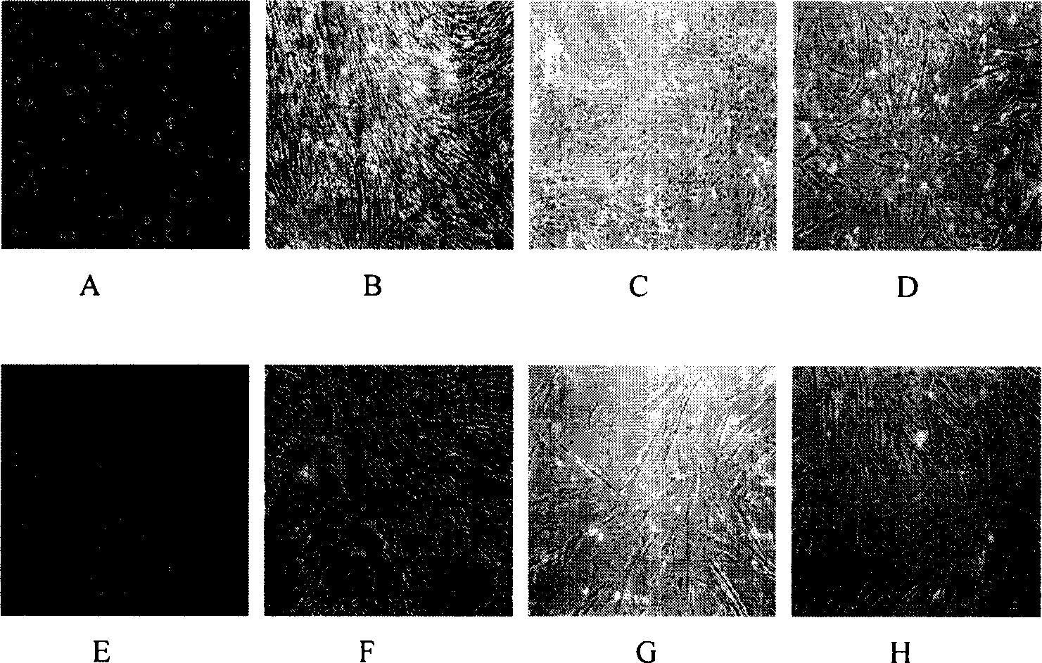 Method of inducing differentiation of human amnion mesenchyme stem cell to nerve cell