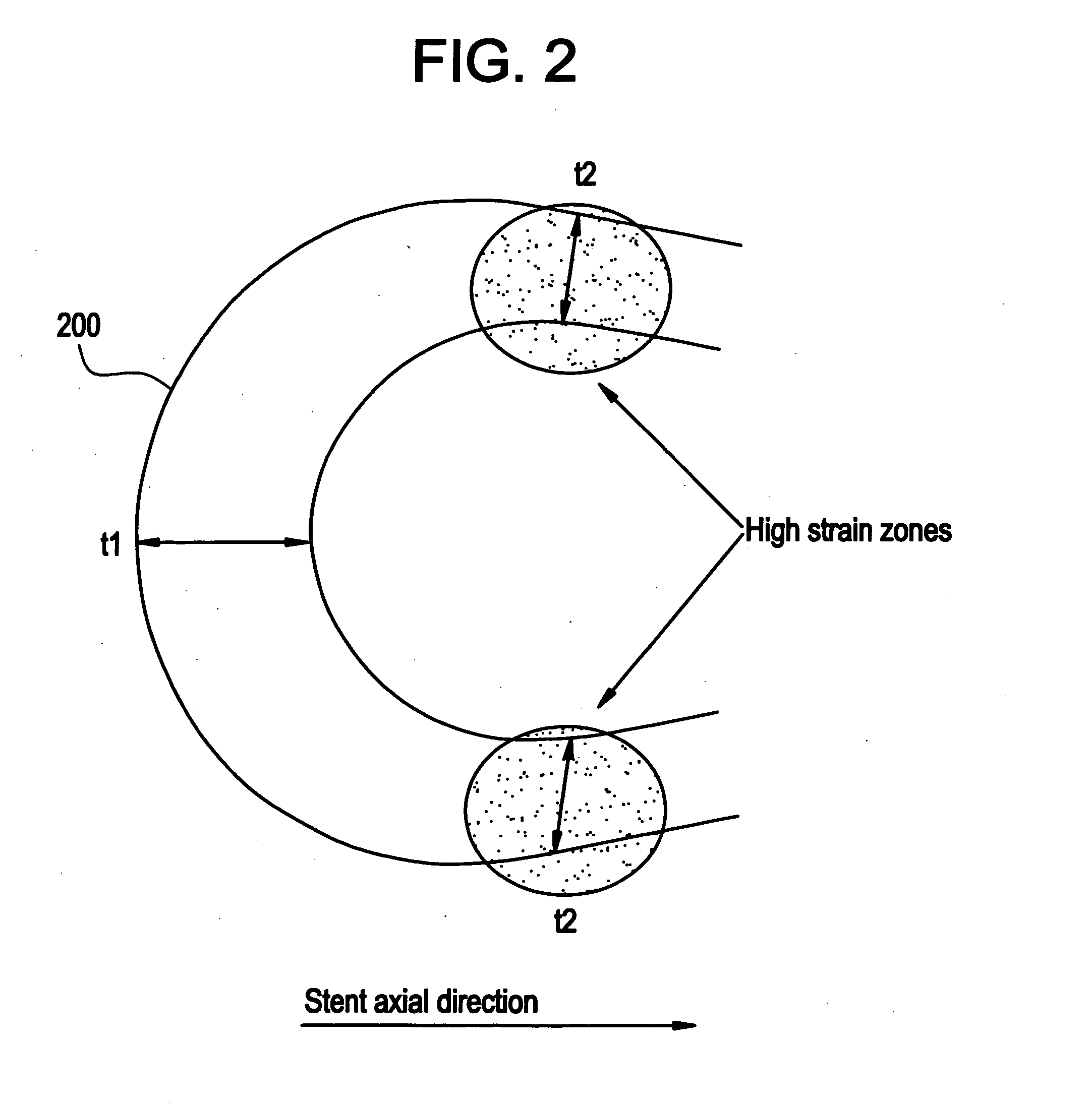 Polymeric stent having modified molecular structures in the flexible connectors and the radial struts of the hoops