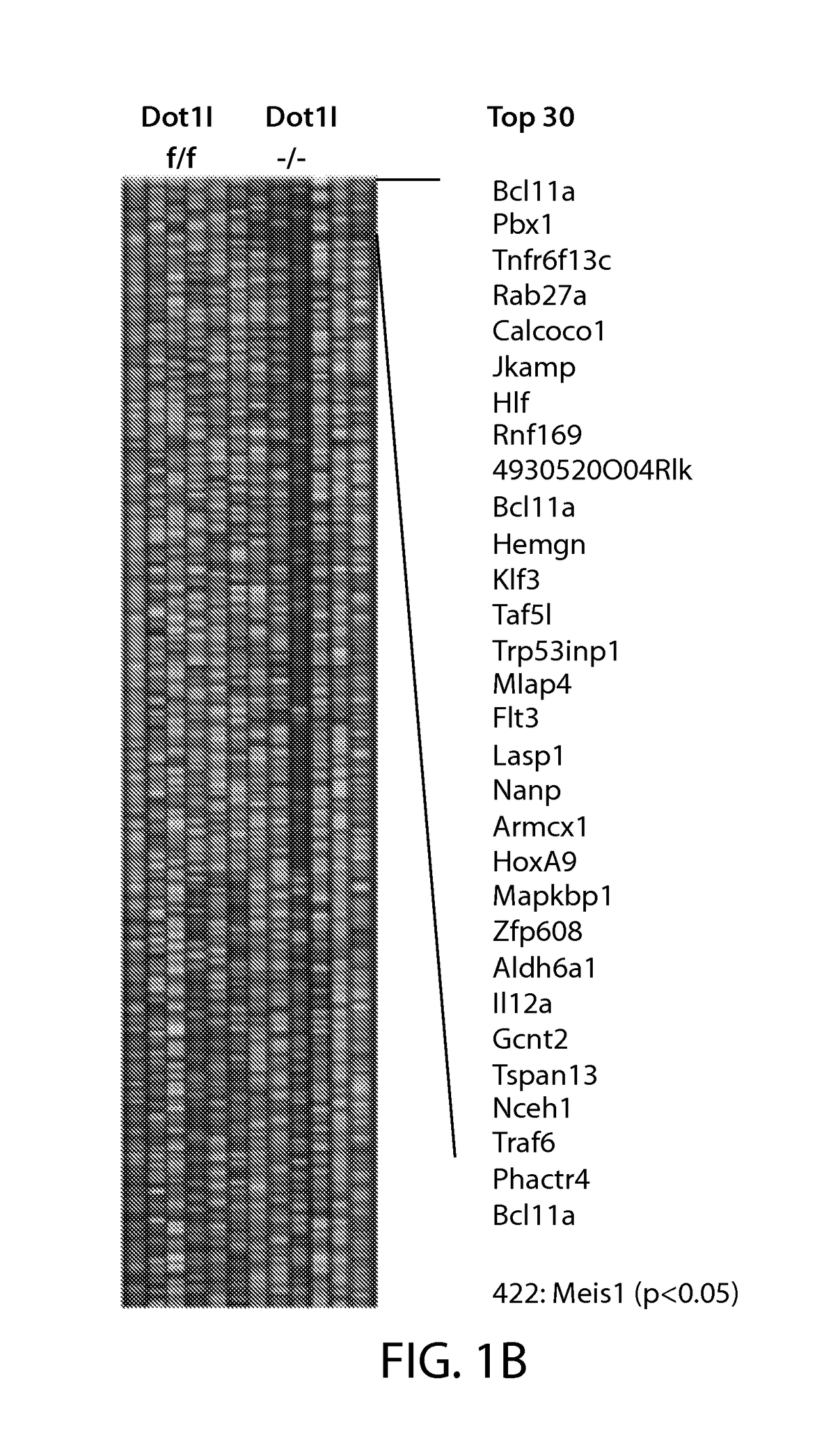 Dot1l inhibition in patients with mn1-high aml