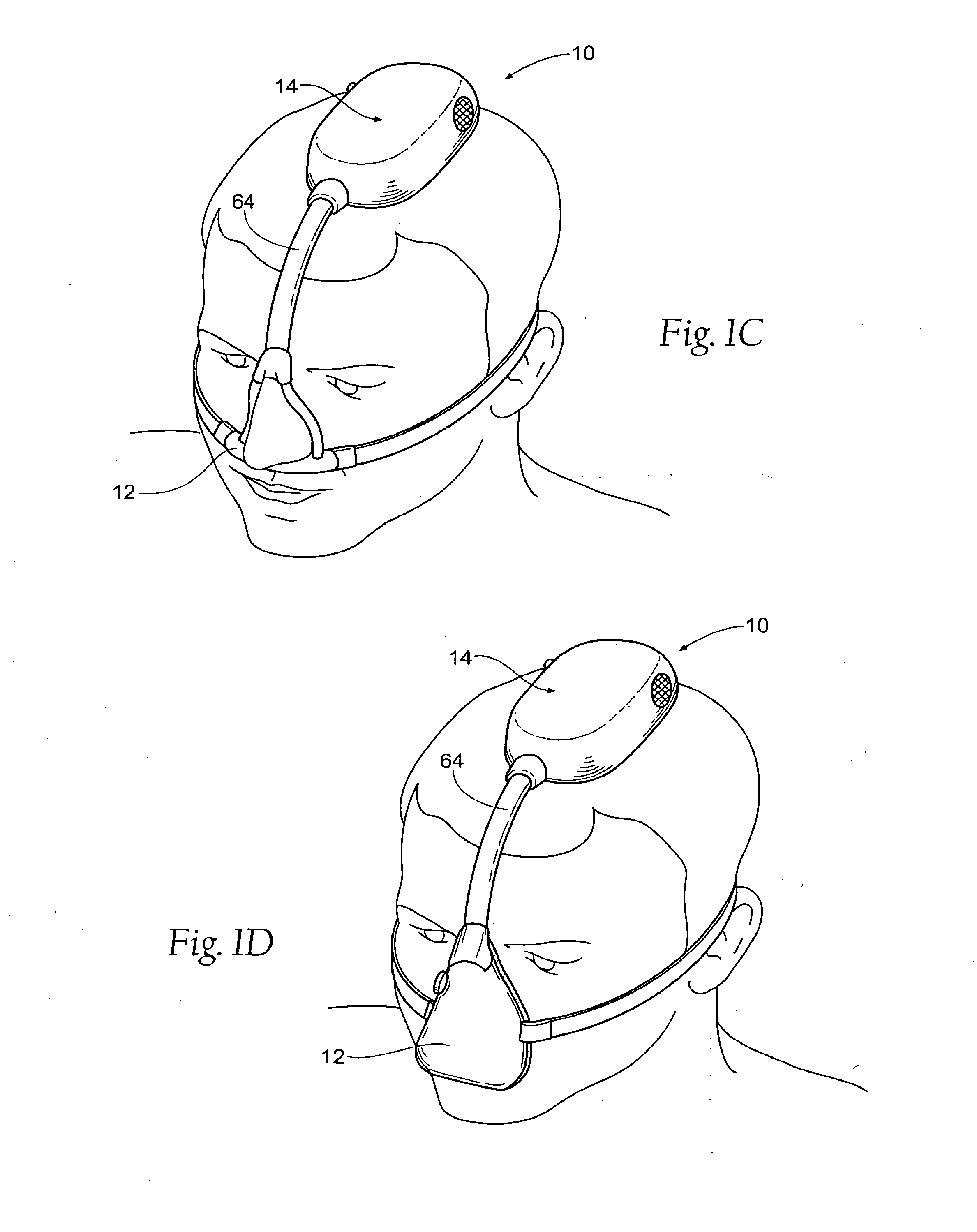 Self-contained, intermittent positive airway pressure systems and methods for treating sleep apnea, snoring, and other respiratory disorders