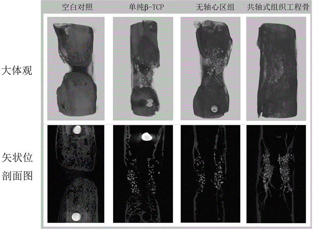 Construction and application of coaxial type vascularized tissue-engineered bone