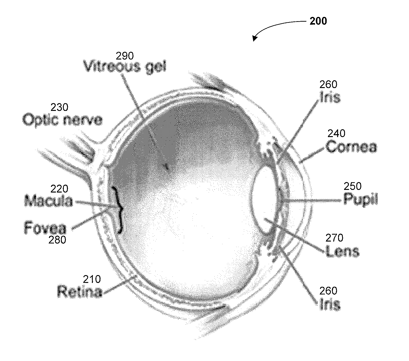 System and method for automated detection of age related macular degeneration and other retinal abnormalities