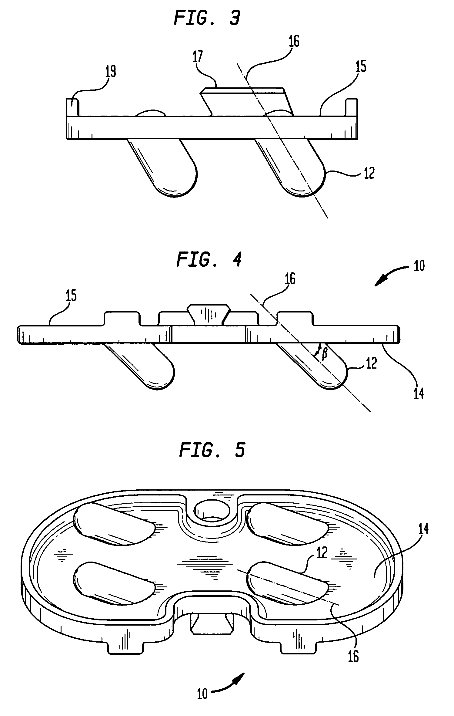 Orthopedic implant with angled pegs