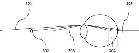 Correction method for prevention and control of myopia and refractive error based on tonic adjustment mechanism