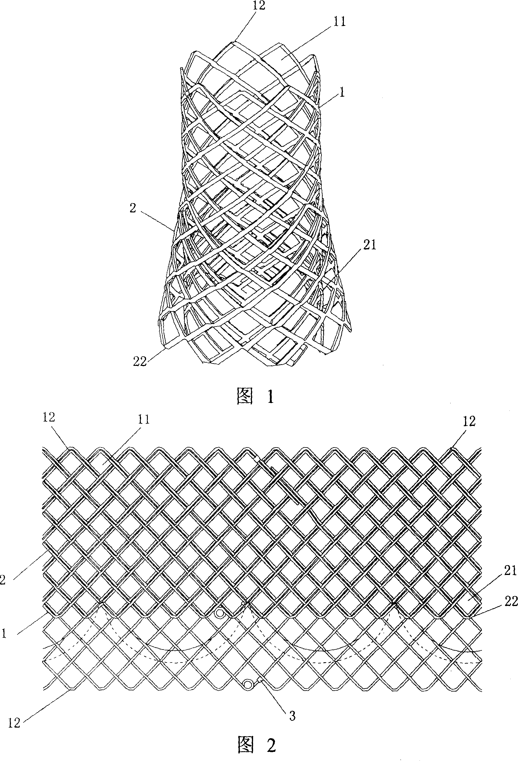 Braided blood vessel stent with external ring-net skirt