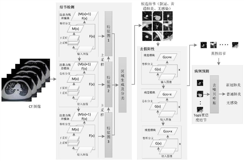 An intelligent diagnosis system for COVID-19 based on deep learning