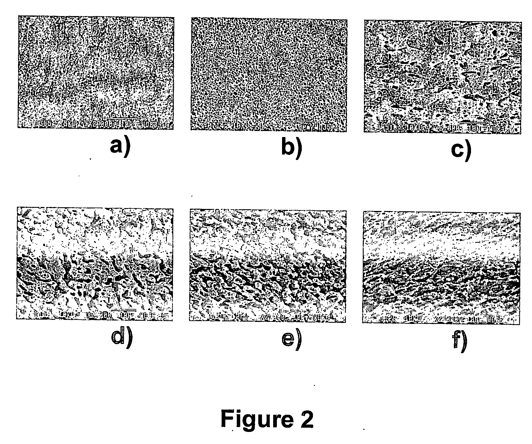 Microporous articles comprising biodegradable medical polymers, method of preparation thereof and method of use thereof